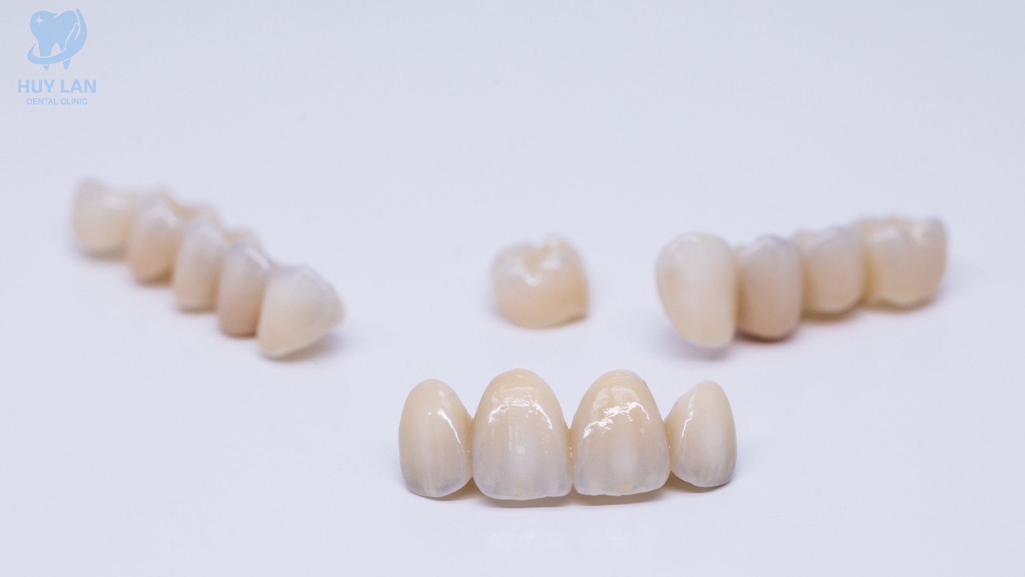 BỌC RĂNG SỨ LÀ GÌ?