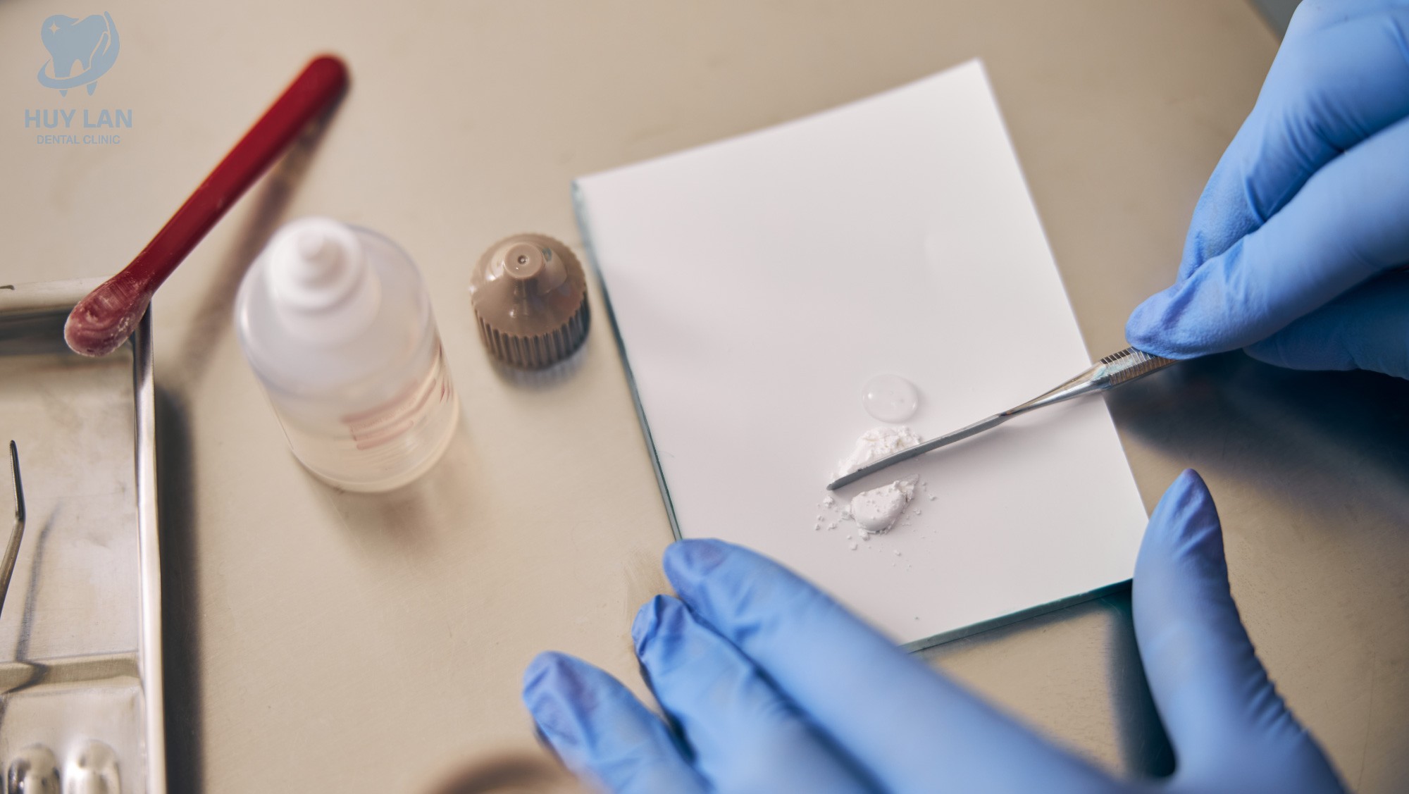 CÁC VẬT LIỆU TRÁM RĂNG THÔNG DỤNG