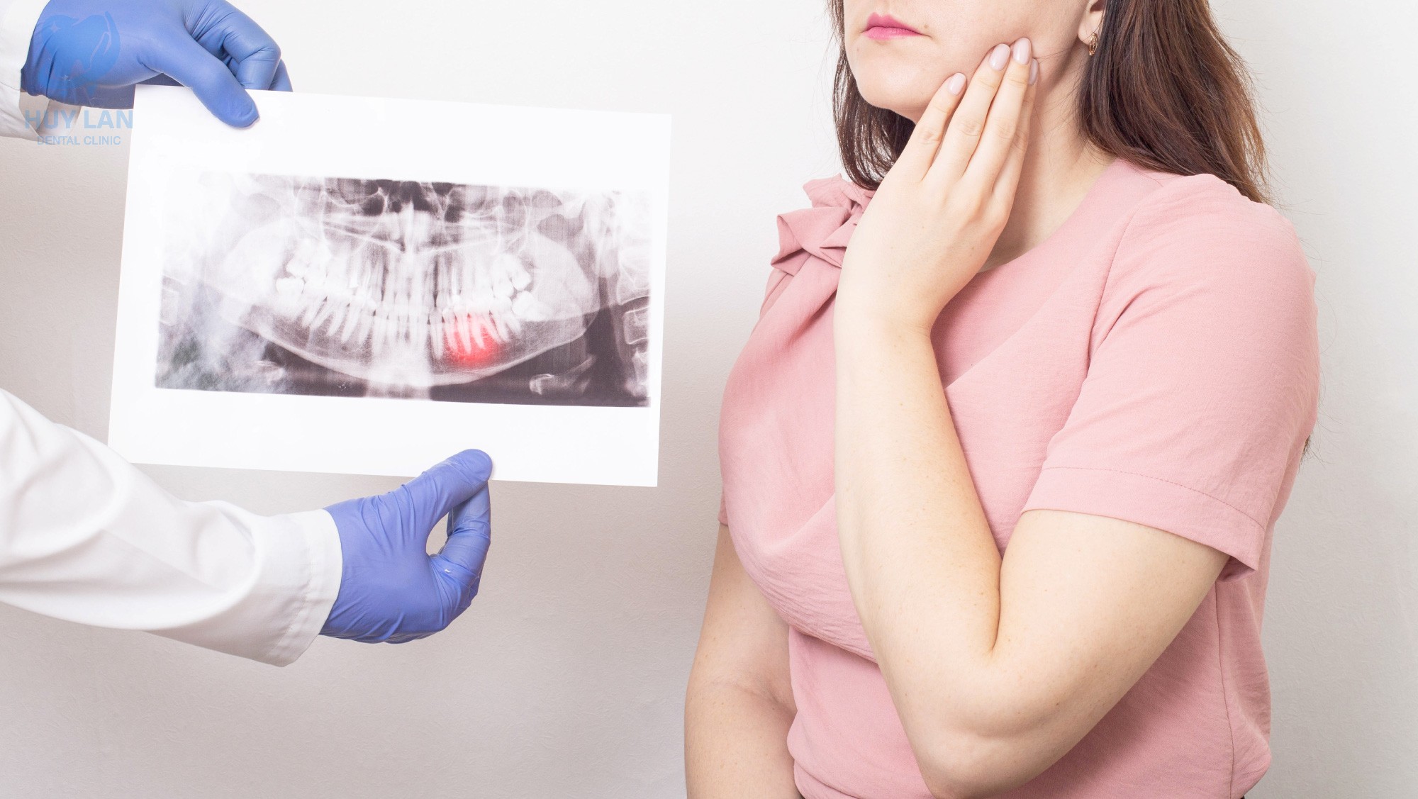 CẤU TRÚC CỦA RĂNG KHÔN