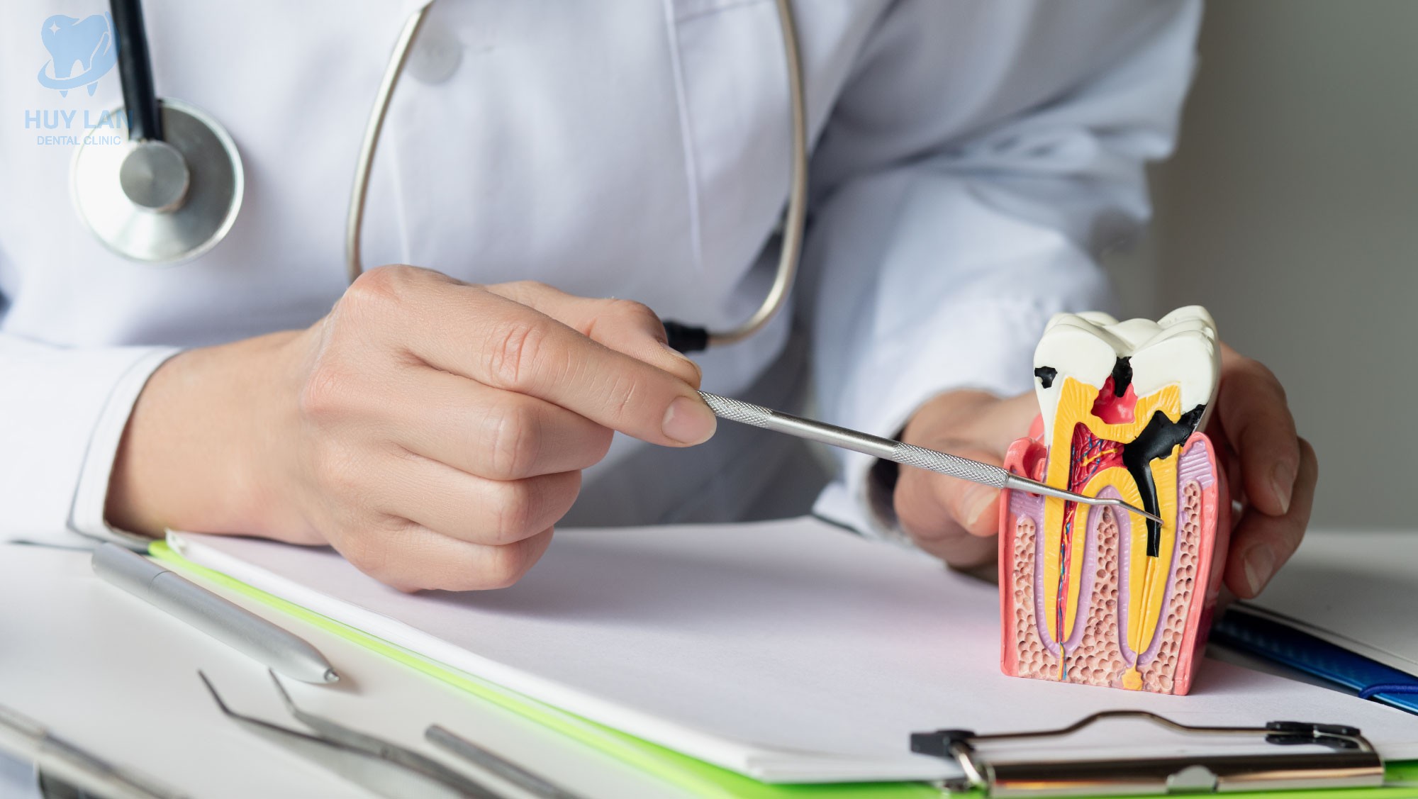 CƠ CHẾ HOẠT ĐỘNG CỦA VIỆC ĐIỀU TRỊ TỦY RĂNG 