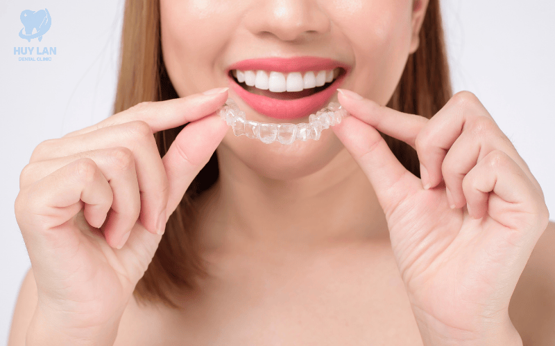 Niềng răng khay trong suốt