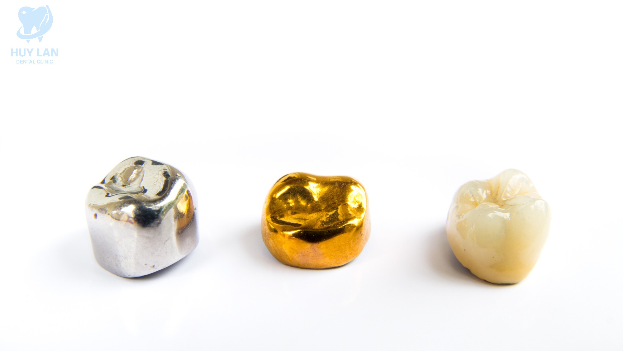 NÊN CHỌN LOẠI <br> RĂNG SỨ NÀO?