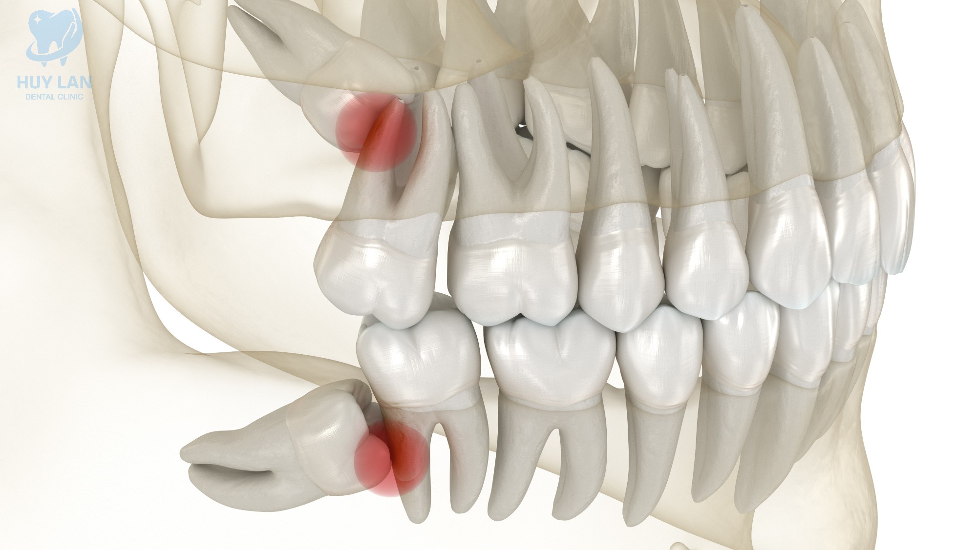 RĂNG KHÔN LÀ GÌ? 