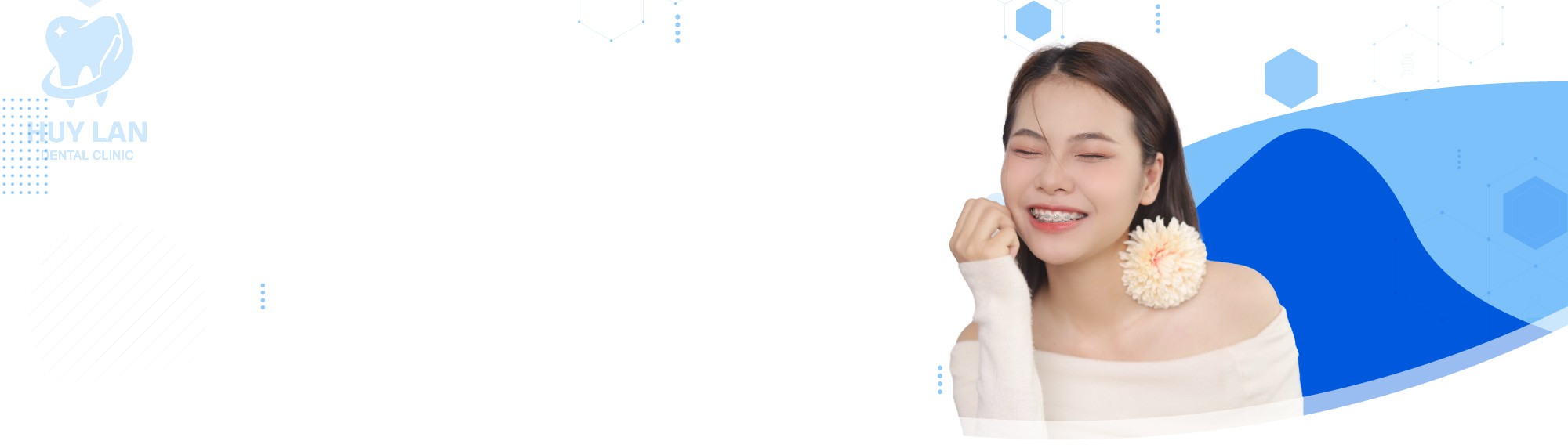 NIỀNG RĂNG MẮC CÀI 