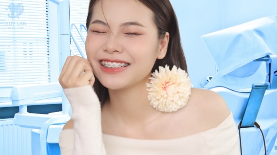 Niềng răng mắc cài