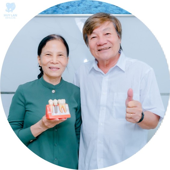 Trồng răng Implant