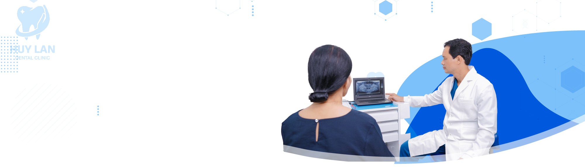 TRỒNG RĂNG IMPLANT ĐƠN LẺ